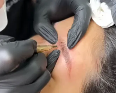 Nanobrows-behandling utförs